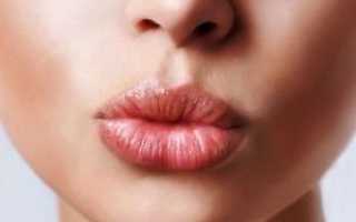 Гиалуроновая кислота для губ: Фото до и после, противопоказания, на сколько хватает эффекта