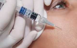 Гиалуроновая кислота уколы под глаза: Фото до и после инъекции от морщин